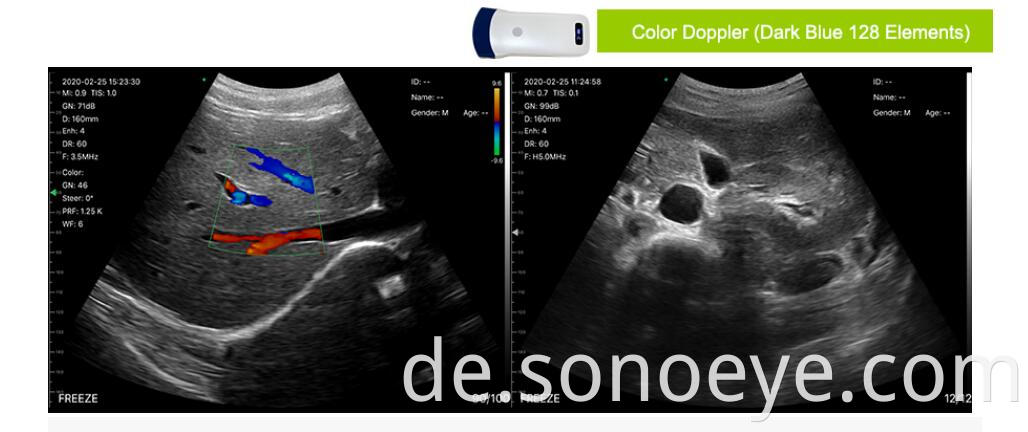 5c ultrasound